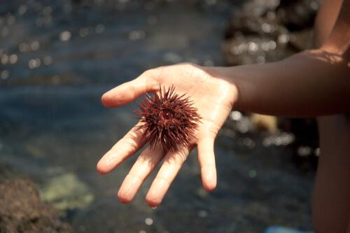 Wenn ma von einem Seeigel gestochen wurde, muss man die Wunde gut säubern.