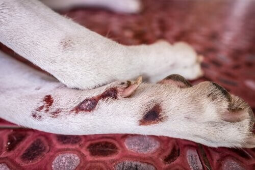Akrale-Leckdermatitis