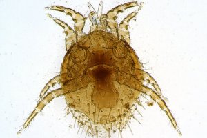 Milben: was sind sie und welches sind ihre Merkmale?